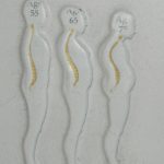 OSTEOPOROSIS1 1 150x150 ไม้เท้าสี่ขา ฐานกว้าง FS922  (WALKING STICK FS922)
