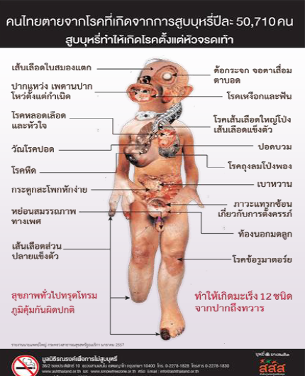 รักชีวิต คิดเลิกบุหรี่ โทษบุหรี่ รักชีวิต คิดเลิกบุหรี่