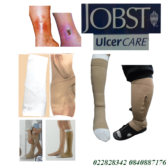 jobst ulcercare เมื่อไรต้องใส่ Jobst ulcercare ถุงน่องเส้นเลือดขอดสำหรับผู้มีแผลที่ขา