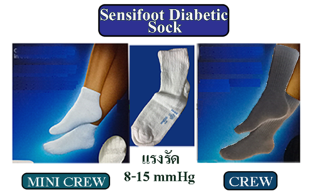 sensifoot diabetic sock cover2 450x283 ผ้ายืด ถุงน่อง ถุงเท้าที่มีแรงรัด